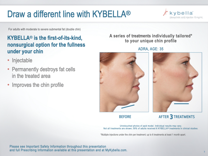 KyBella-Northern-KY-Cincinnati-Permanent-Submental-Fat-Removal-Nonsurgical