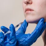 Dermal Fillers