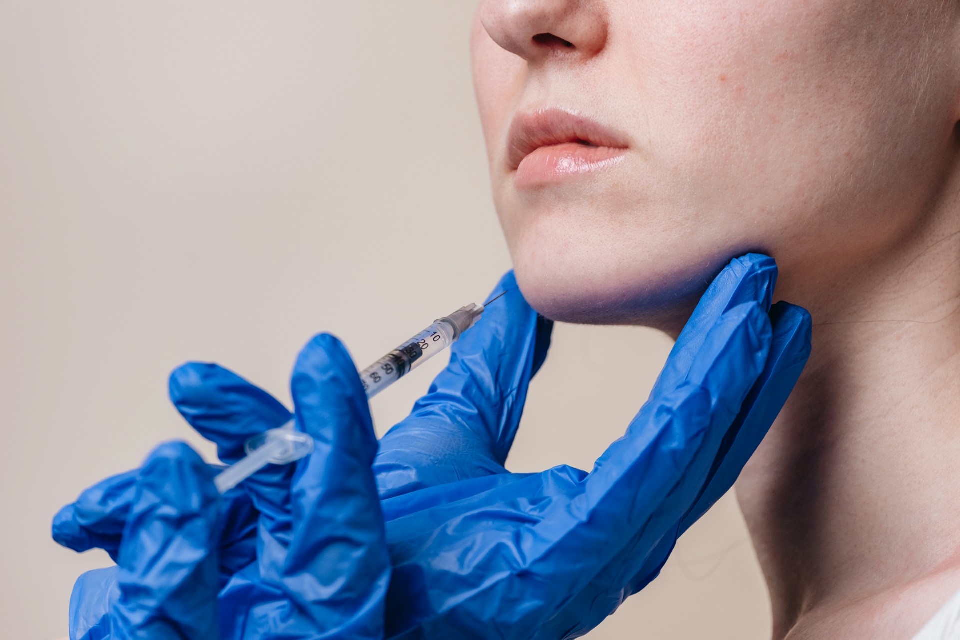 Dermal Fillers