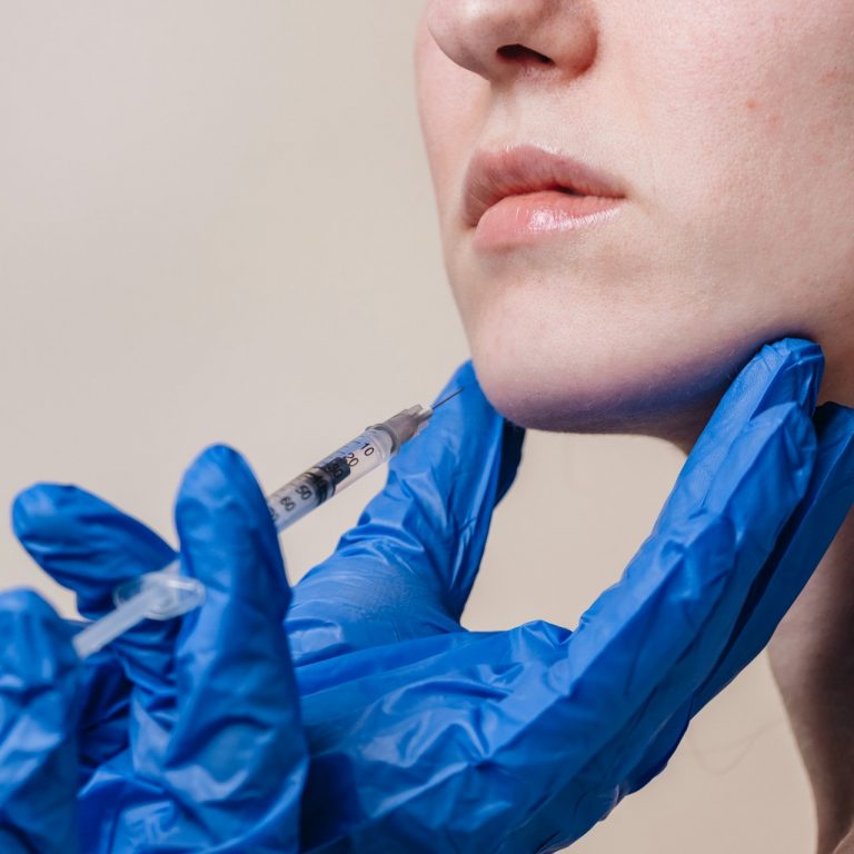 Dermal Fillers